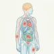 severe infections mental neurological disorders two year risk map